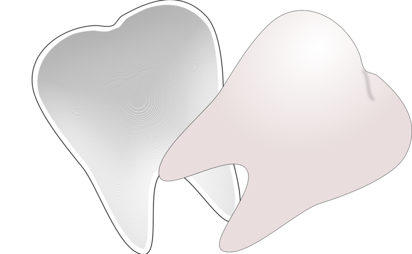 Przepiękne urodziwe zęby dodatkowo doskonały cudny uśmieszek to powód do zadowolenia.